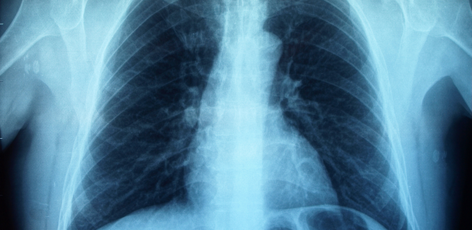 Mobile Occupational X-Ray Services | FITMed24